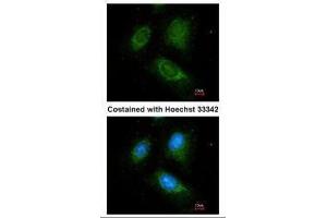 ICC/IF Image Immunofluorescence analysis of methanol-fixed HeLa, using ACADM, antibody at 1:100 dilution. (Medium-Chain Specific Acyl-CoA Dehydrogenase, Mitochondrial (N-Term) 抗体)