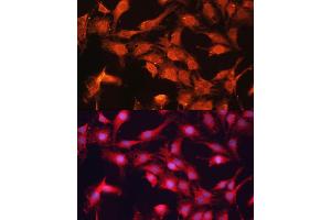 Immunofluorescence analysis of C6 cells using  antibody (ABIN6129849, ABIN6136345, ABIN6136346 and ABIN6217907) at dilution of 1:100. (ABCB10 抗体  (AA 230-300))