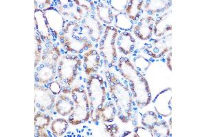 Immunohistochemistry of paraffin-embedded mouse kidney using Lumican (LUM) (LUM) Rabbit mAb (ABIN7268309) at dilution of 1:100 (40x lens). (LUM 抗体)