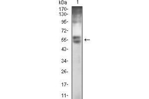 Western Blotting (WB) image for anti-Glypican 3 (GPC3) (AA 359-554) antibody (ABIN7193621)