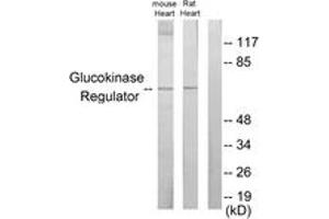 Western Blotting (WB) image for anti-Glucokinase (Hexokinase 4) Regulator (GCKR) (AA 211-260) antibody (ABIN2889589) (GCKR 抗体  (AA 211-260))