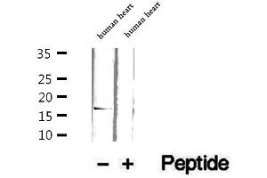 Western blot analysis of extracts of human heart tissue, using GMFG antibody. (GMFG 抗体  (Internal Region))