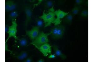 Anti-CORO1B mouse monoclonal antibody (ABIN2452912) immunofluorescent staining of COS7 cells transiently transfected by pCMV6-ENTRY CORO1B (RC203023). (CORO1B 抗体)