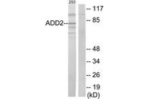 Western blot analysis of extracts from 293 cells, using ADD2 Antibody. (ADD2 抗体  (AA 471-520))