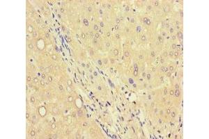 Immunohistochemistry of paraffin-embedded human liver tissue using ABIN7174872 at dilution of 1:100 (C6orf223 抗体  (AA 9-89))