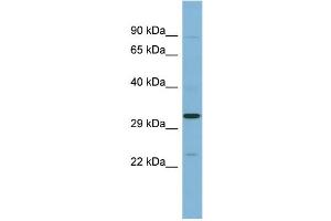 WB Suggested Anti-SET Antibody Titration: 0.