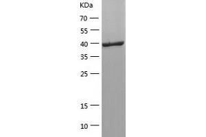 Selenoprotein P Protein (SEPP1) (AA 20-381) (His tag)