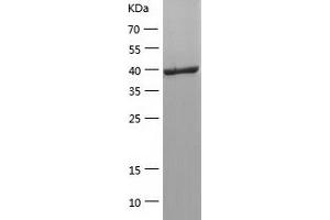 Western Blotting (WB) image for Selenoprotein P (SEPP1) (AA 20-381) protein (His tag) (ABIN7125017) (Selenoprotein P Protein (SEPP1) (AA 20-381) (His tag))
