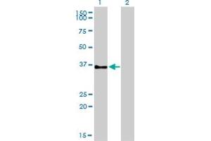 Western Blotting (WB) image for anti-G Protein-Coupled Receptor 3 (GPR3) (AA 1-330) antibody (ABIN561101)