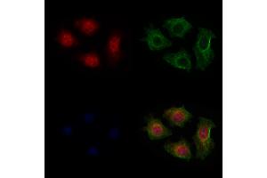 ABIN6265048 and ABIN6279809 staining HepG2 cells by IF/ICC.