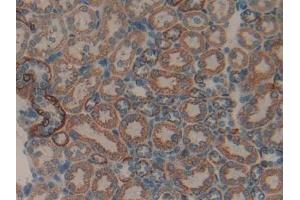 Immunohistochemistry (IHC) image for anti-Matrix Metallopeptidase 9 (Gelatinase B, 92kDa Gelatinase, 92kDa Type IV Collagenase) (MMP9) (AA 226-391) antibody (ABIN7432019)
