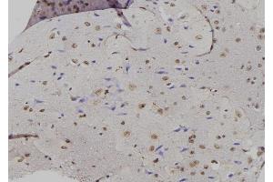 ABIN6261869 and ABIN6276885 at 1/100 staining Mouse brain tissue by IHC-P.
