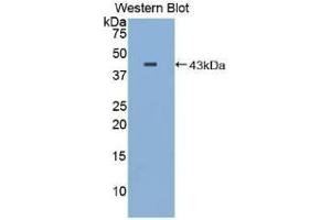 WB of Protein Standard: different control antibodies against Highly purified E. (Major Basic Protein ELISA 试剂盒)