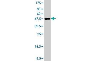 Western Blot detection against Immunogen (37 KDa) . (Formin 2 抗体  (AA 144-243))