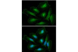 ICC/IF analysis of GLUL in HeLa cells. (GLN1 抗体  (AA 1-373))