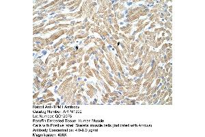 Rabbit Anti-TPM1 Antibody  Paraffin Embedded Tissue: Human Muscle Cellular Data: Skeletal muscle cells Antibody Concentration: 4. (Tropomyosin 抗体  (N-Term))