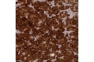 Immunohistochemical staining of human pancreas with PPP1R3F polyclonal antibody  shows strong cytoplasmic positivity in exocrine glands. (PPP1R3F 抗体)
