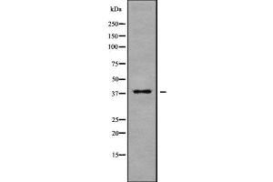 Western blot analysis of MARCH9 using MCF7 whole cell lysates (MARCH9 抗体  (N-Term))