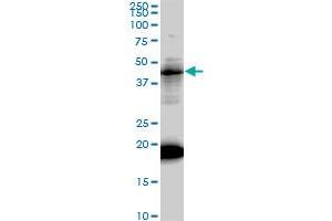 LEF1 monoclonal antibody (M01), clone 3H5. (LEF1 抗体  (AA 1-399))