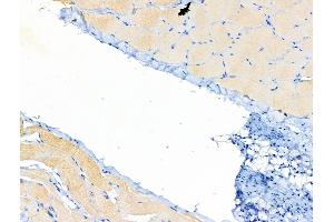 ABIN6258031 and ABIN6274975 at 1/100 staining Rat skin tissue by IHC-P. (CPT1B 抗体  (Internal Region))