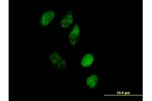 Immunofluorescence of purified MaxPab antibody to EAF1 on HeLa cell. (EAF1 抗体  (AA 1-268))