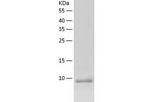 Western Blotting (WB) image for Chemokine (C-X-C Motif) Ligand 16 (CXCL16) (AA 27-114) protein (His tag) (ABIN7122334) (CXCL16 Protein (AA 27-114) (His tag))