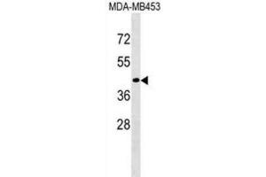 Western Blotting (WB) image for anti-CD200 Receptor 1-Like (CD200R1L) antibody (ABIN3000748) (CD200R1L 抗体)