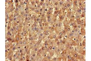 Immunohistochemistry of paraffin-embedded human liver tissue using ABIN7161655 at dilution of 1:100 (NLRX1 抗体  (AA 45-205))