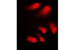 Immunofluorescent analysis of CBP staining in A431 cells. (CBP 抗体  (C-Term))