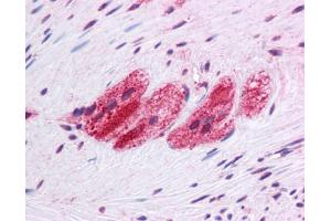 Immunohistochemistry (IHC) image for anti-Selenoprotein N, 1 (SEPN1) (C-Term) antibody (ABIN617009) (SEPN1 抗体  (C-Term))