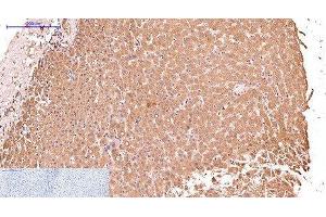 Immunohistochemistry of paraffin-embedded Human liver tissue using CK-17 Monoclonal Antibody at dilution of 1:200. (KRT17 抗体)