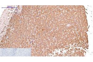 Immunohistochemistry of paraffin-embedded Human liver tissue using CK-17 Monoclonal Antibody at dilution of 1:200.