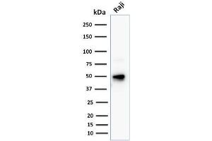 Western Blot Analysis of human Raji cell lysate using CD79a Mouse Monoclonal Antibody (JCB117 + HM47/A9). (CD79a 抗体  (AA 202-216))