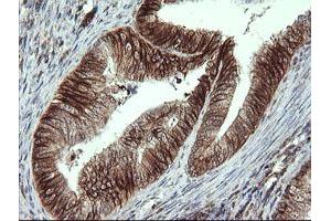 Immunohistochemistry (IHC) image for anti-ALX Homeobox 4 (ALX4) antibody (ABIN1496621) (ALX4 抗体)