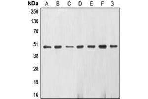 Western blot analysis of Gamma-enolase expression in U937 (A), K562 (B), Jurkat (C), NIH3T3 (D), KNRK (E), HepG2 (F), HeLa (G) whole cell lysates. (ENO2/NSE 抗体  (C-Term))