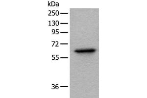 Western blot analysis of Hela cell lysate using BAIAP2L1 Polyclonal Antibody at dilution of 1:1000 (BAIAP2L1 抗体)