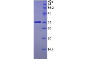 SDS-PAGE analysis of Human FKBP10 Protein. (FKBP10 蛋白)