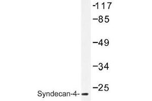 Image no. 1 for anti-Syndecan 4 (SDC4) antibody (ABIN317791) (SDC4 抗体)