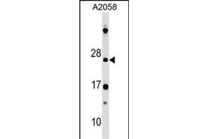 DR Antibody (N-term) 8211a western blot analysis in  cell line lysates (35 μg/lane). (DRAP1 抗体  (N-Term))