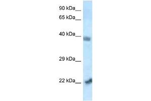 WB Suggested Anti-Vps72 Antibody   Titration: 1. (VPS72 抗体  (N-Term))
