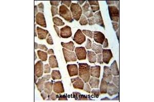 Immunohistochemistry (Paraffin-embedded Sections) (IHC (p)) image for anti-ATP Synthase, H+ Transporting, Mitochondrial F1 Complex, O Subunit (ATP5O) (AA 38-64), (N-Term) antibody (ABIN652503)