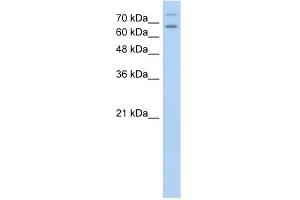 TSHR antibody used at 1 ug/ml to detect target protein. (TSH receptor 抗体  (N-Term))