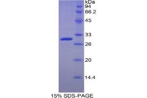 SDS-PAGE analysis of Human Adenosine Kinase Protein. (ADK 蛋白)