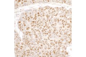 Immunohistochemistry (IHC) image for anti-Minichromosome Maintenance Complex Component 3 (MCM3) (AA 500-550) antibody (ABIN7453566) (MCM3 抗体  (AA 500-550))