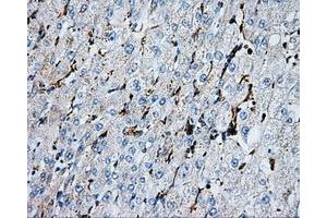 Immunohistochemical staining of paraffin-embedded liver tissue using anti-PSMC3mouse monoclonal antibody. (PSMC3 抗体)
