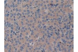 Detection of GAB3 in Mouse Ovary Tissue using Polyclonal Antibody to GRB2 Associated Binding Protein 3 (GAB3) (GAB3 抗体  (AA 142-375))