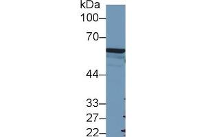 Western blot analysis of Human A549 cell lysate, using Mouse FOXP3 Antibody (2 µg/ml) and HRP-conjugated Goat Anti-Rabbit antibody ( (FOXP3 抗体  (AA 190-412))