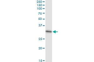 Immunoprecipitation of CACYBP transfected lysate using anti-CACYBP MaxPab rabbit polyclonal antibody and Protein A Magnetic Bead , and immunoblotted with CACYBP purified MaxPab mouse polyclonal antibody (B01P) . (CACYBP 抗体  (AA 1-228))