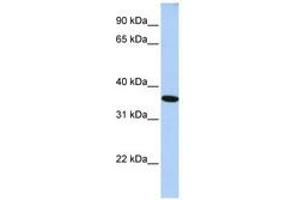 anti-General Transcription Factor IIA, 1, 19/37kDa (GTF2A1) (N-Term) antibody