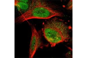 Immunofluorescent staining of human cell line U-251 MG shows positivity in nucleoli & nucleus but not nucleoli. (DNAJC14 抗体)